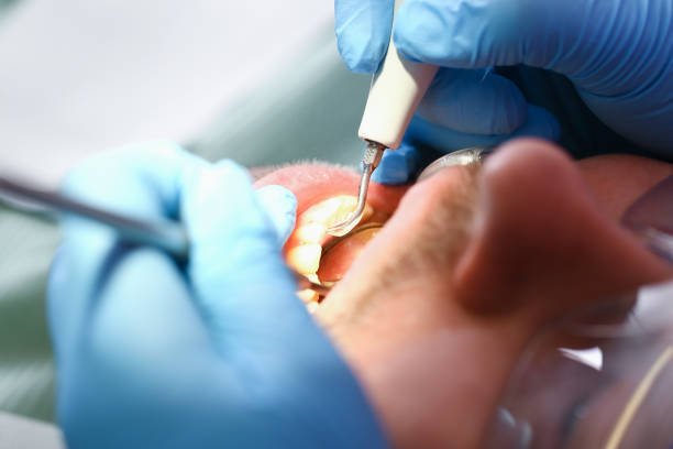 Best Emergency Denture Repair in Richmond, MN