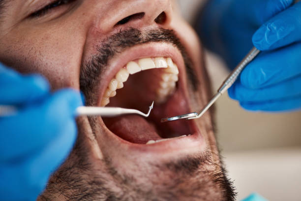 Best Pediatric Emergency Dentist in Richmond, MN