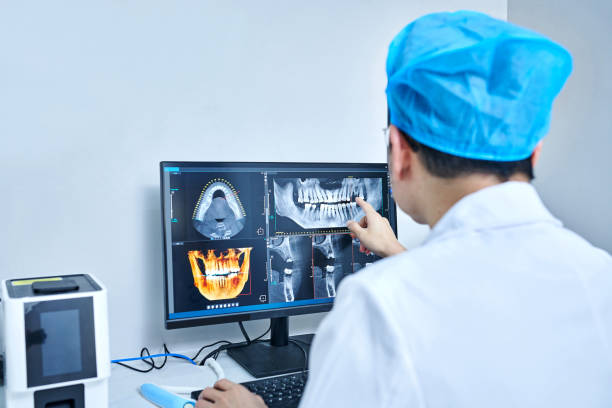 Best Emergency Dental Care for Broken or Chipped Teeth in Richmond, MN